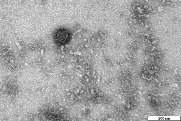 В России коронавирус впервые показали под микроскопом