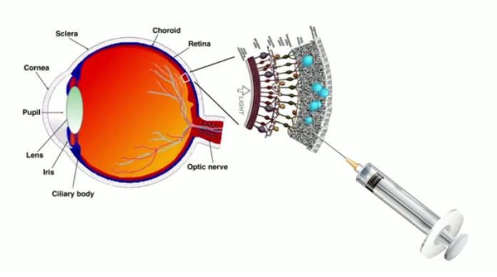 Создан первый в мире жидкий протез сетчатки глаза